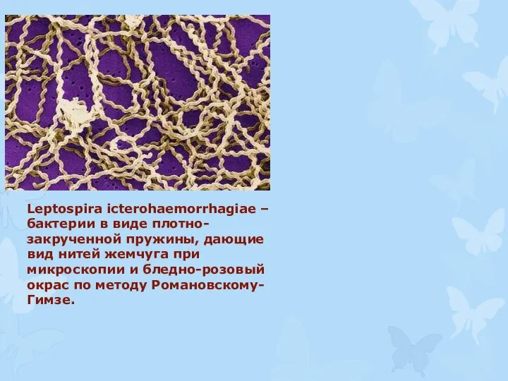 Leptospira icterohaemorrhagiae – бактерии в виде плотно-закрученной пружины, дающие вид нитей жемчуга