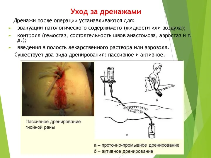 Уход за дренажами Дренажи после операции устанавливаются для: эвакуации патологического содержимого (жидкости