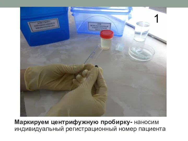 Маркируем центрифужную пробирку- наносим индивидуальный регистрационный номер пациента