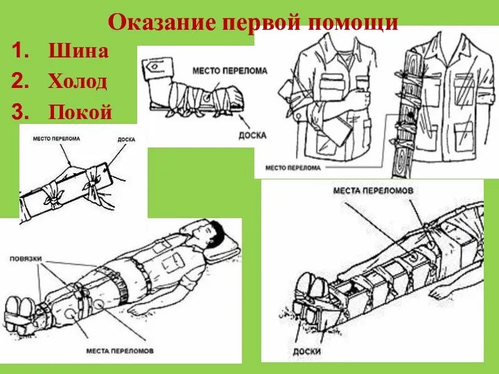 Оказание первой помощи Шина Холод Покой