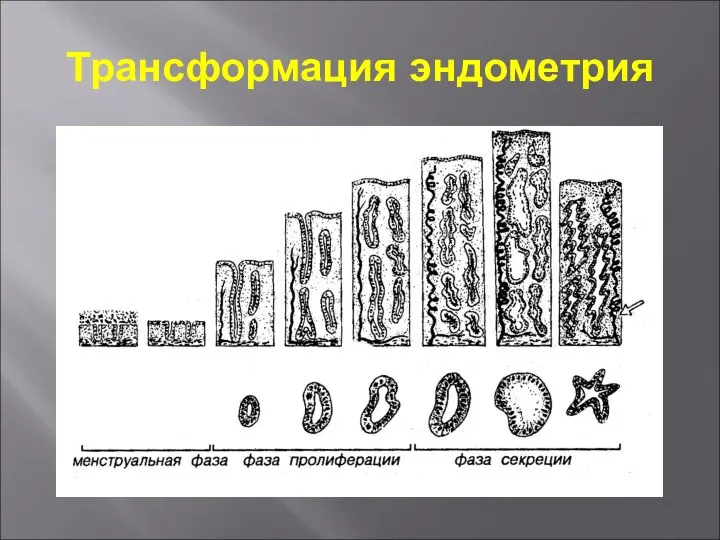 Трансформация эндометрия