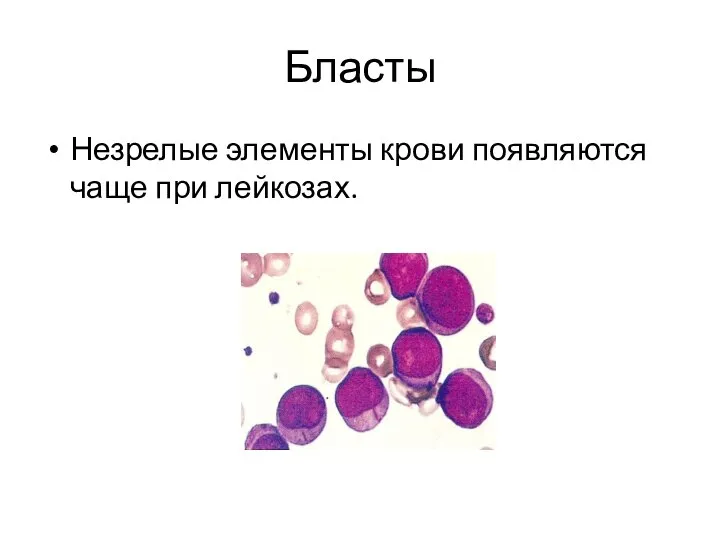 Бласты Незрелые элементы крови появляются чаще при лейкозах.