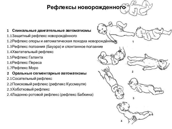 Рефлексы новорожденного 1 Спинальные двигательные автоматизмы 1.1 Защитный рефлекс новорождённого 1.2 Рефлекс