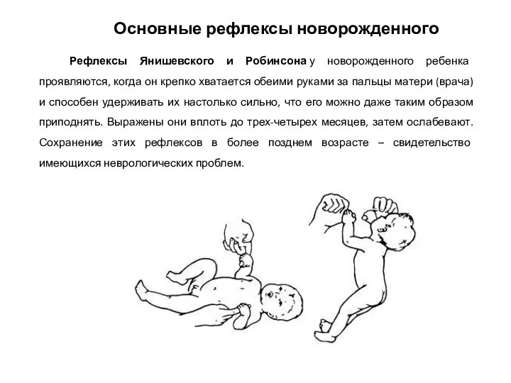 Рефлексы Янишевского и Робинсона у новорожденного ребенка проявляются, когда он крепко хватается
