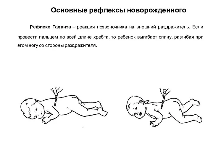 Рефлекс Галанта – реакция позвоночника на внешний раздражитель. Если провести пальцем по