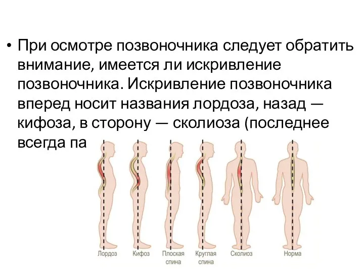 При осмотре позвоночника следует обратить внимание, имеется ли искривление позвоночника. Искривление позвоночника