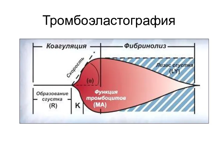 Тромбоэластография