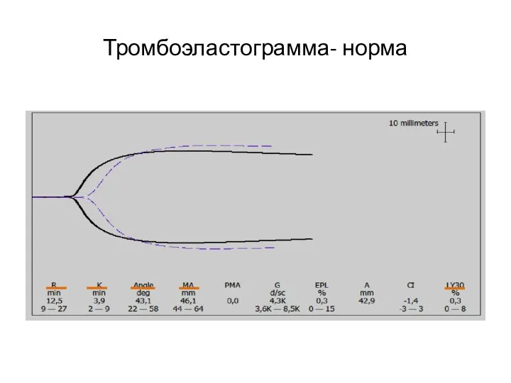 Тромбоэластограмма- норма