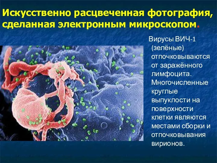 Искусственно расцвеченная фотография, сделанная электронным микроскопом. Вирусы ВИЧ-1 (зелёные) отпочковываются от заражённого