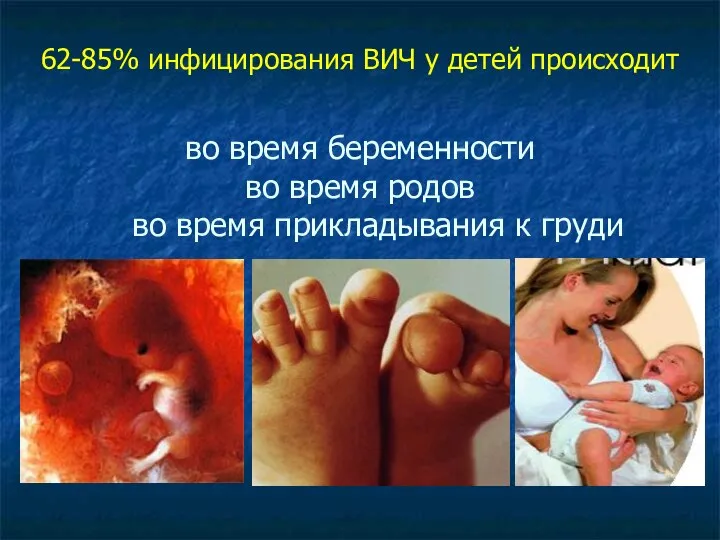 62-85% инфицирования ВИЧ у детей происходит во время беременности во время родов