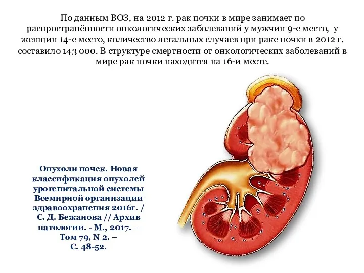 Опухоли почек. Новая классификация опухолей урогенитальной системы Всемирной организации здравоохранения 2016г. /