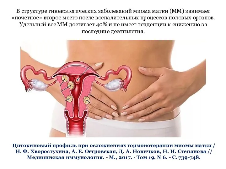 Цитокиновый профиль при осложнениях гормонотерапии миомы матки / Н. Ф. Хворостухина, А.