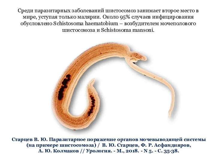 Старцев В. Ю. Паразитарное поражение органов мочевыводящей системы (на примере шистосомоза) /