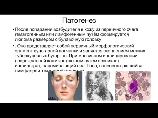 Патогенез После попадания возбудителя в кожу из первичного очага гематогенным или лимфогенным