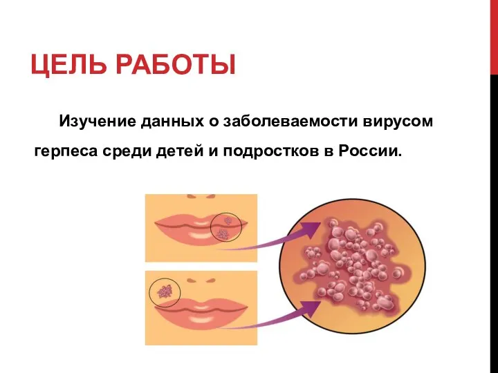 ЦЕЛЬ РАБОТЫ Изучение данных о заболеваемости вирусом герпеса среди детей и подростков в России.