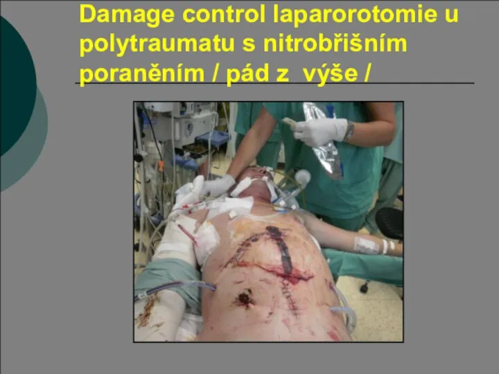 Damage control laparorotomie u polytraumatu s nitrobřišním poraněním / pád z výše /