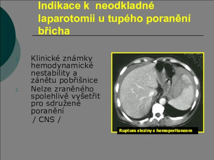 Indikace k neodkladné laparotomii u tupého poranění břicha Klinické známky hemodynamické nestability