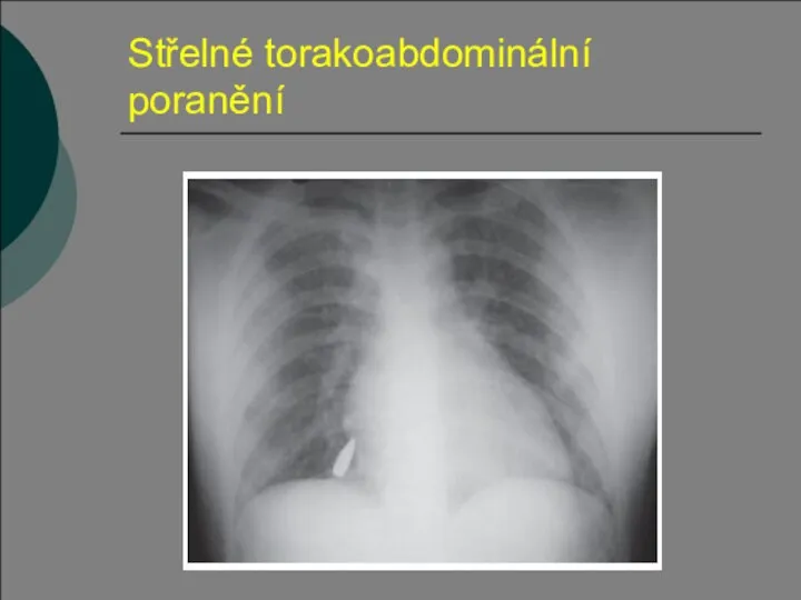 Střelné torakoabdominální poranění