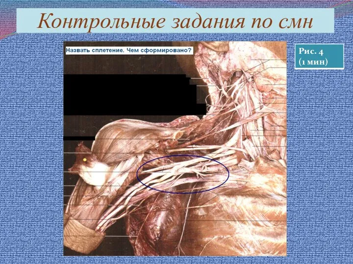 Контрольные задания по смн