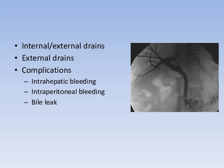 Internal/external drains External drains Complications Intrahepatic bleeding Intraperitoneal bleeding Bile leak