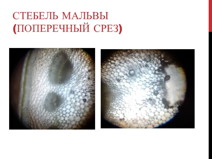 СТЕБЕЛЬ МАЛЬВЫ (ПОПЕРЕЧНЫЙ СРЕЗ)