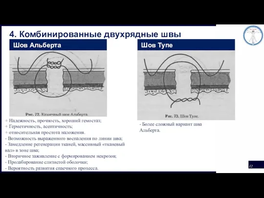 4. Комбинированные двухрядные швы Шов Альберта Шов Тупе + Надежность, прочность, хороший