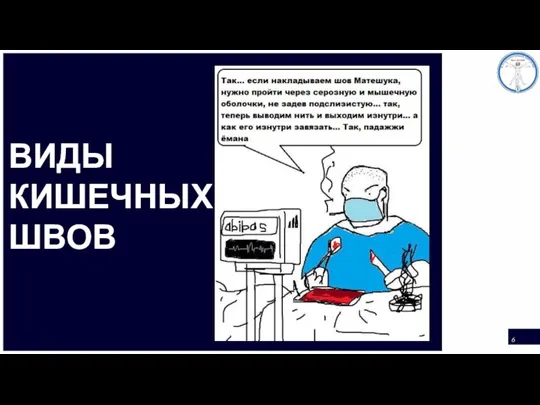 ВИДЫ КИШЕЧНЫХ ШВОВ