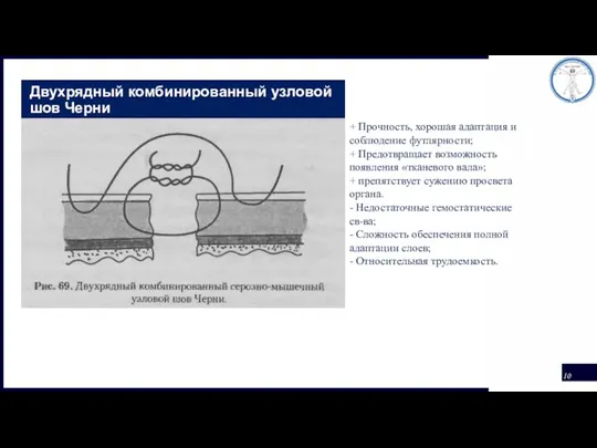 Двухрядный комбинированный узловой шов Черни + Прочность, хорошая адаптация и соблюдение футлярности;