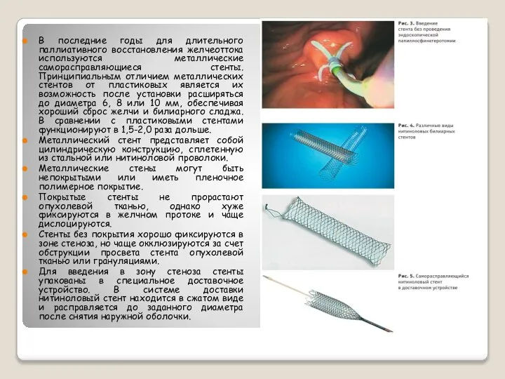 В последние годы для длительного паллиативного восстановления желчеоттока используются металлические саморасправляющиеся стенты.