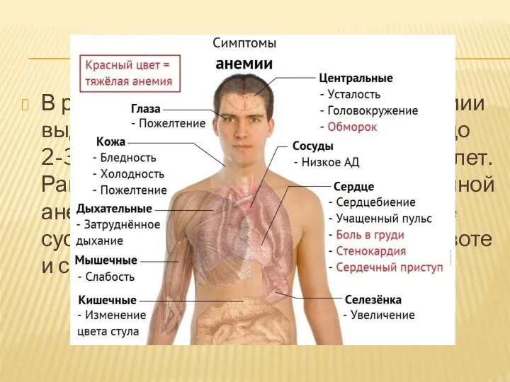 В развитии серповидно-клеточной анемии выделяют три периода: I - с 6 месяцев