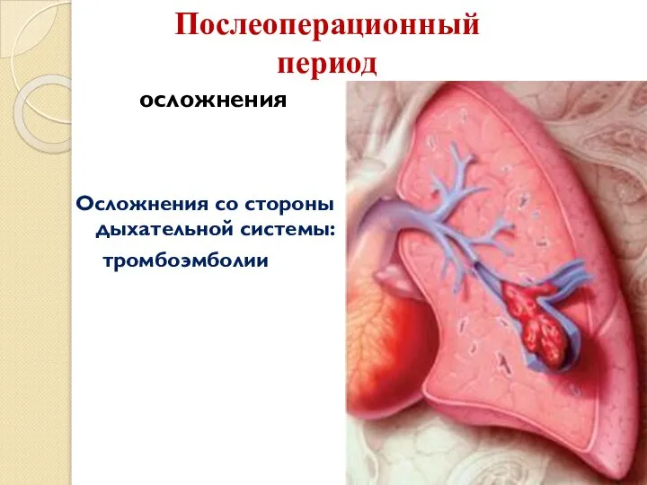 Послеоперационный период осложнения Осложнения со стороны дыхательной системы: тромбоэмболии