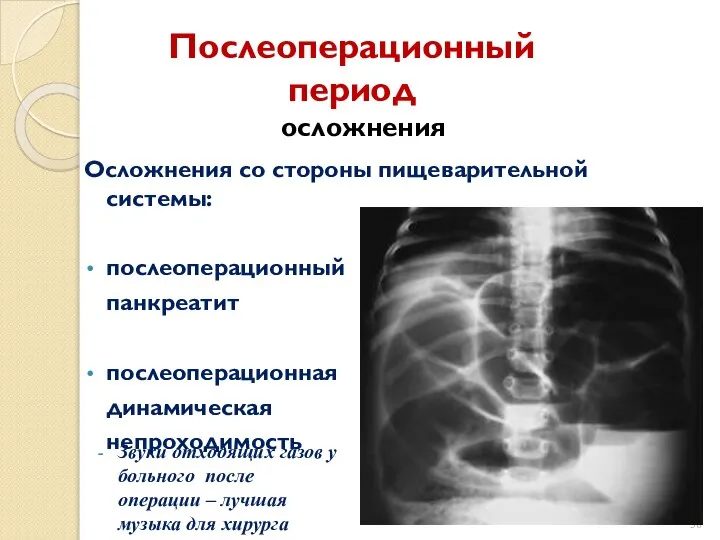 Послеоперационный период осложнения Осложнения со стороны пищеварительной системы: послеоперационный панкреатит послеоперационная динамическая