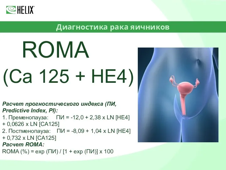 Диагностика рака яичников ROMA (Ca 125 + HE4) Расчет прогностического индекса (ПИ,