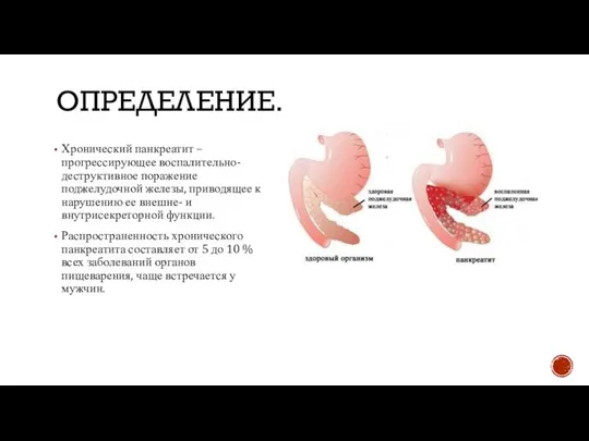 ОПРЕДЕЛЕНИЕ. Хронический панкреатит – прогрессирующее воспалительно-деструктивное поражение поджелудочной железы, приводящее к нарушению