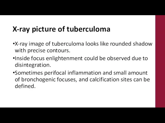 X-ray picture of tuberculoma X-ray image of tuberculoma looks like rounded shadow