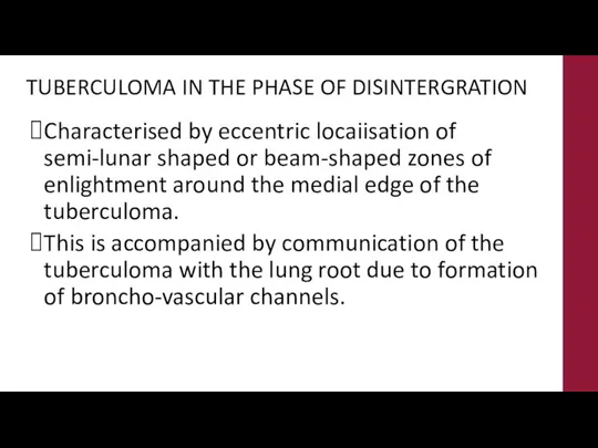 TUBERCULOMA IN THE PHASE OF DISINTERGRATION Characterised by eccentric locaiisation of semi-lunar