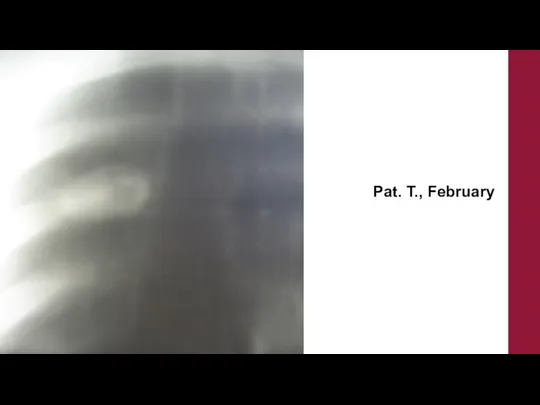 Pat. T., February