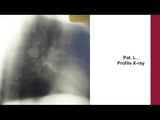 Pat. L., Profile X-ray