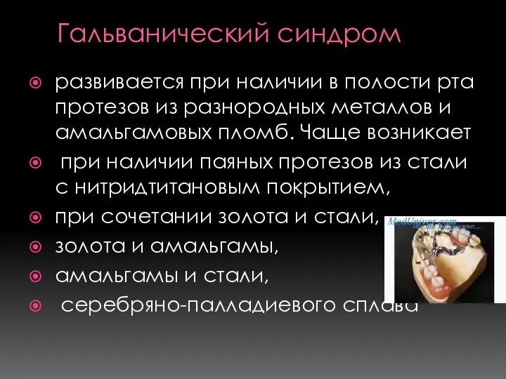 Гальванический синдром развивается при наличии в полости рта протезов из разнородных металлов