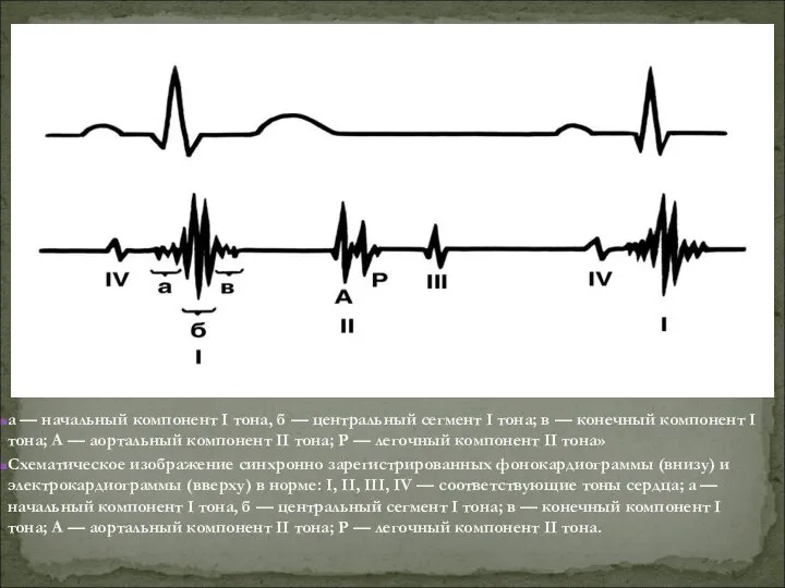а — начальный компонент I тона, б — центральный сегмент I тона;