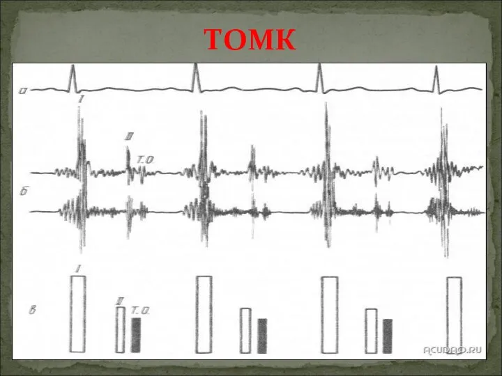 ТОМК