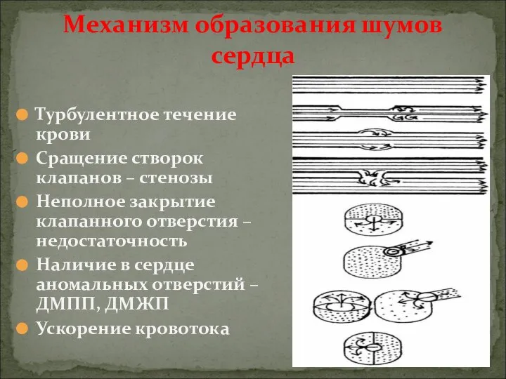 Турбулентное течение крови Сращение створок клапанов – стенозы Неполное закрытие клапанного отверстия