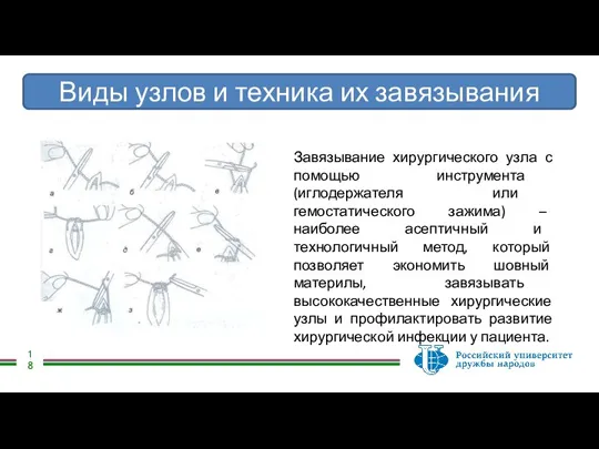 Виды узлов и техника их завязывания Завязывание хирургического узла с помощью инструмента