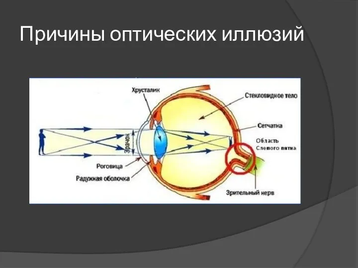 Причины оптических иллюзий