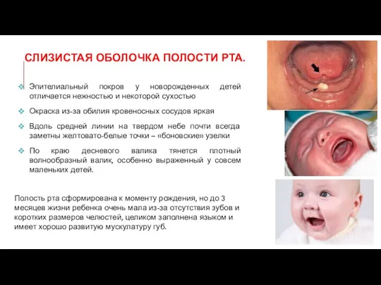 СЛИЗИСТАЯ ОБОЛОЧКА ПОЛОСТИ РТА. Эпителиальный покров у новорожденных детей отличается нежностью и