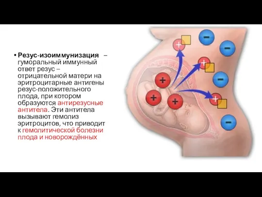 Резус-изоиммунизация – гуморальный иммунный ответ резус – отрицательной матери на эритроцитарные антигены