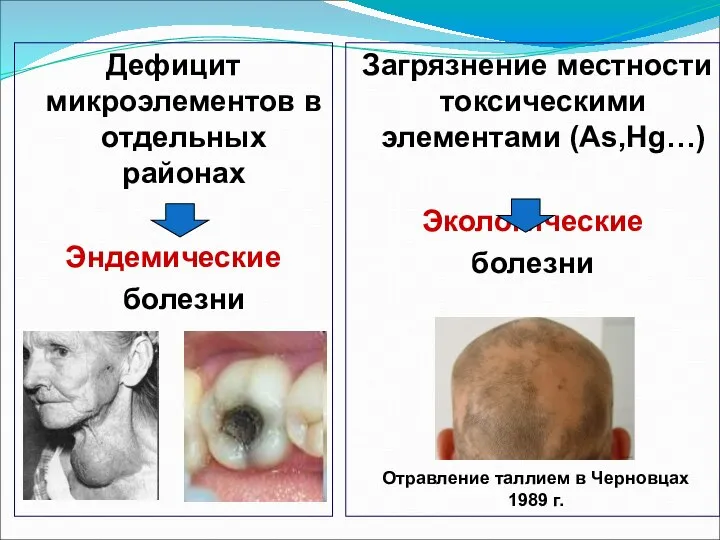 Дефицит микроэлементов в отдельных районах Эндемические болезни Загрязнение местности токсическими элементами (Аs,Hg…)