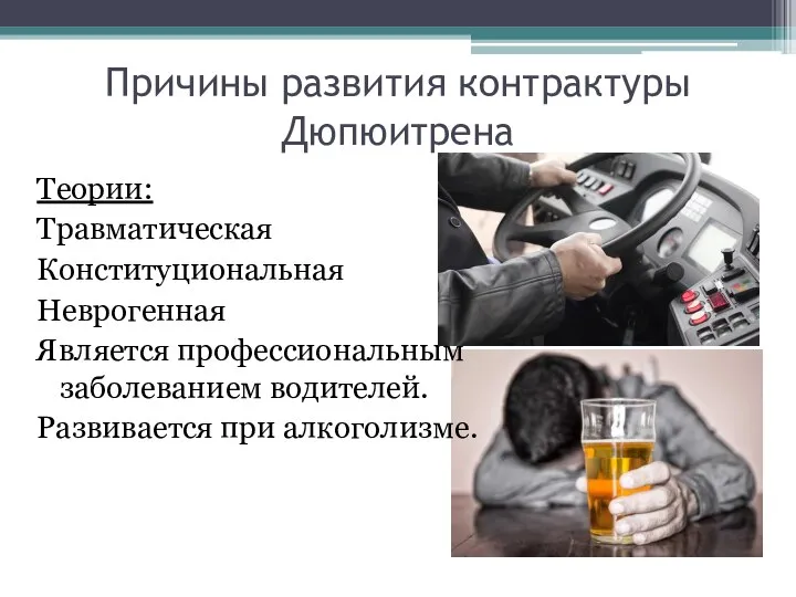 Причины развития контрактуры Дюпюитрена Теории: Травматическая Конституциональная Неврогенная Является профессиональным заболеванием водителей. Развивается при алкоголизме.