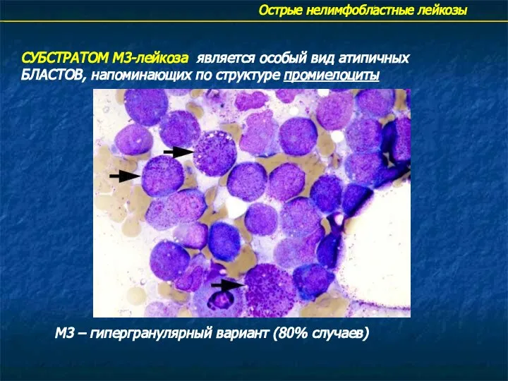 Острые нелимфобластные лейкозы СУБСТРАТОМ М3-лейкоза является особый вид атипичных БЛАСТОВ, напоминающих по