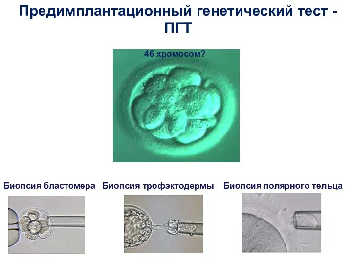 Зачем проводить ПГС? Предимплантационный генетический тест - ПГТ Биопсия бластомера Биопсия трофэктодермы